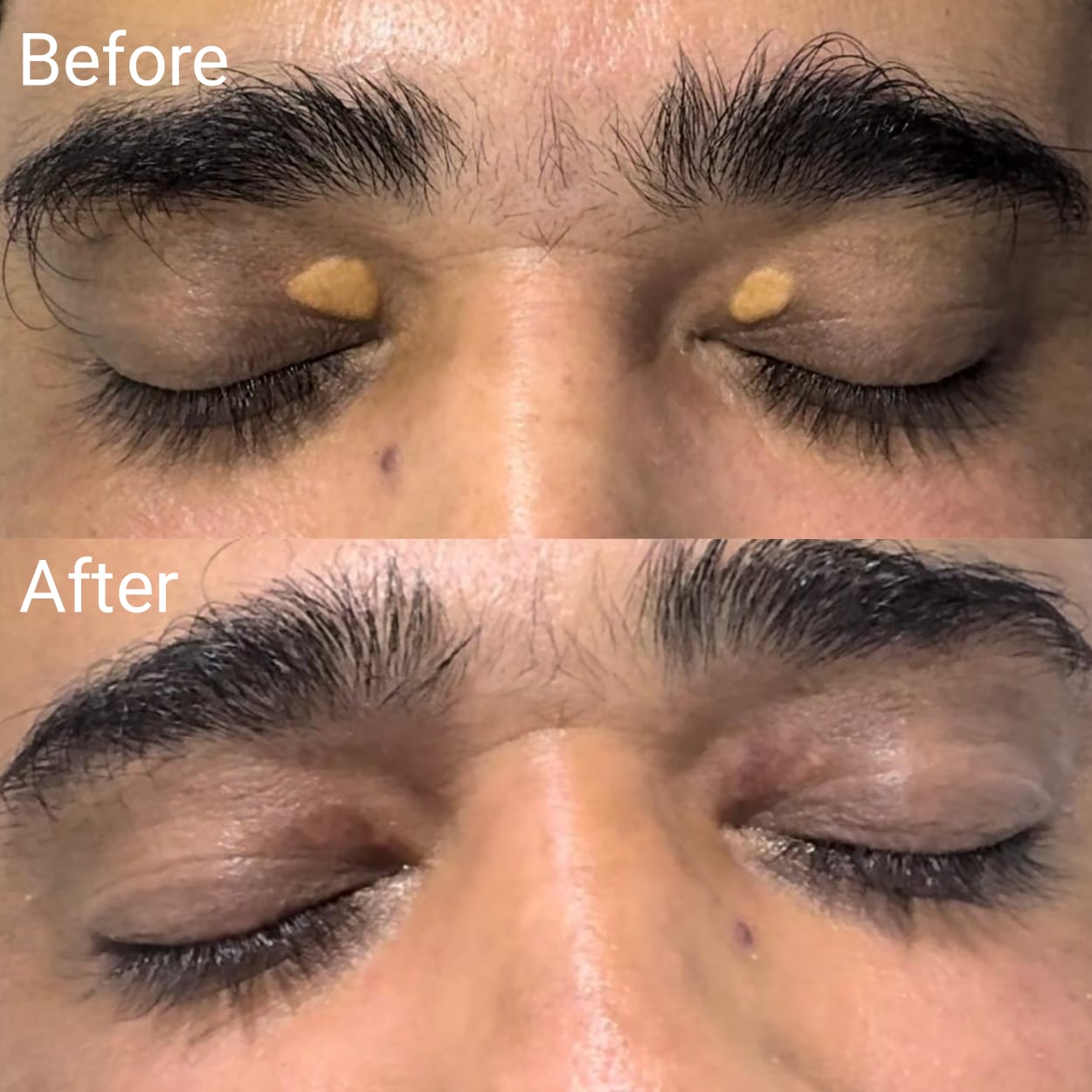 Before After Results