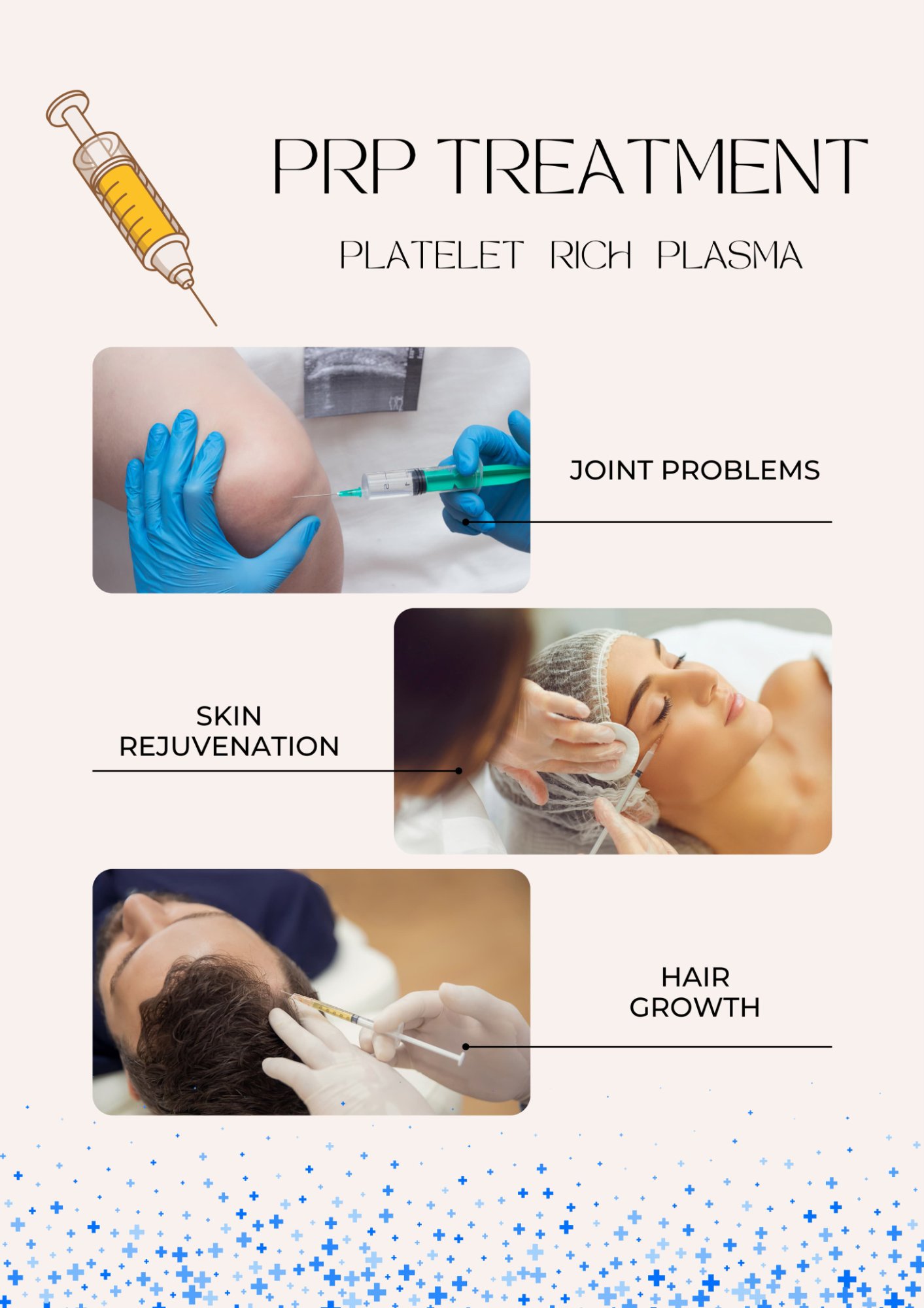 PRP Treatments